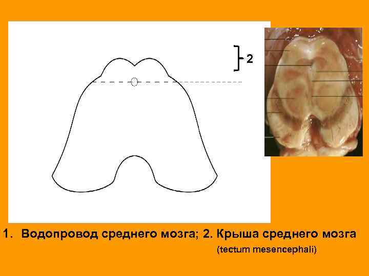 2 1. Водопровод среднего мозга; 2. Крыша среднего мозга (tectum mesencephali) 