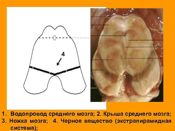 4 1. Водопровод среднего мозга; 2. Крыша среднего мозга; 3. Ножка мозга; 4. Черное