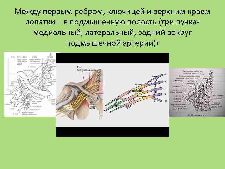 Между первым ребром, ключицей и верхним краем лопатки – в подмышечную полость (три пучкамедиальный,