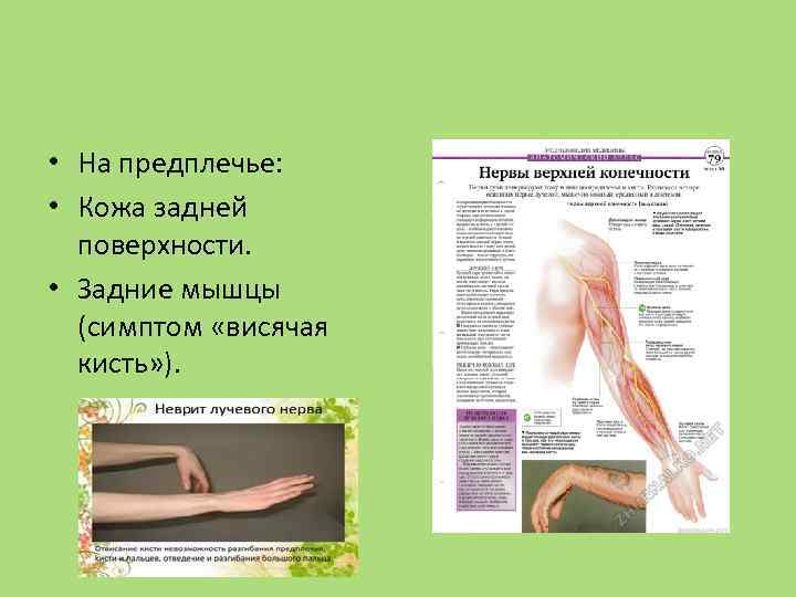  • На предплечье: • Кожа задней поверхности. • Задние мышцы (симптом «висячая кисть»