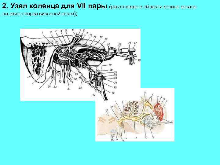 2. Узел коленца для VII пары (расположен в области колена канала лицевого нерва височной