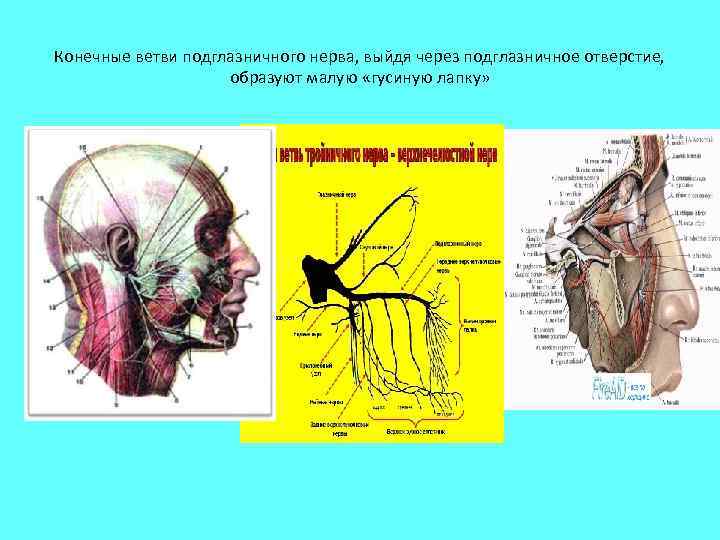 Конечные ветви подглазничного нерва, выйдя через подглазничное отверстие, образуют малую «гусиную лапку» 