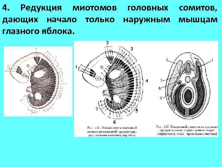 4. Редукция миотомов головных сомитов, дающих начало только наружным мышцам глазного яблока. 