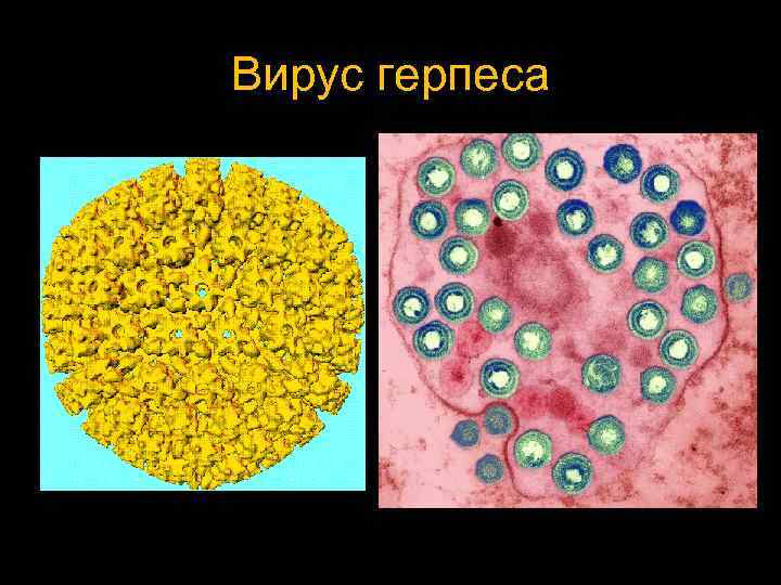 Вирус герпеса 