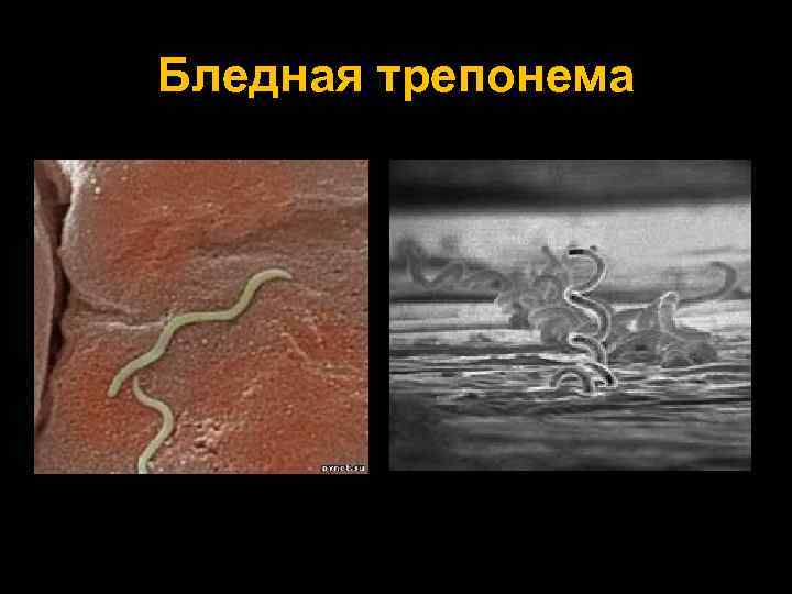 Бледная трепонема 