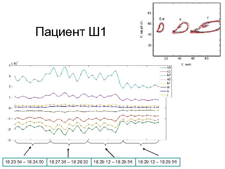 Пациент Ш 1 18: 23: 54 – 18: 24: 50 18: 27: 36 –
