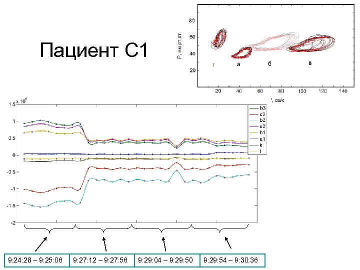 Пациент С 1 9: 24: 28 – 9: 25: 06 9: 27: 12 –