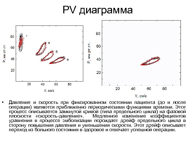 PV диаграмма • Давление и скорость при фиксированном состоянии пациента (до и после операции)