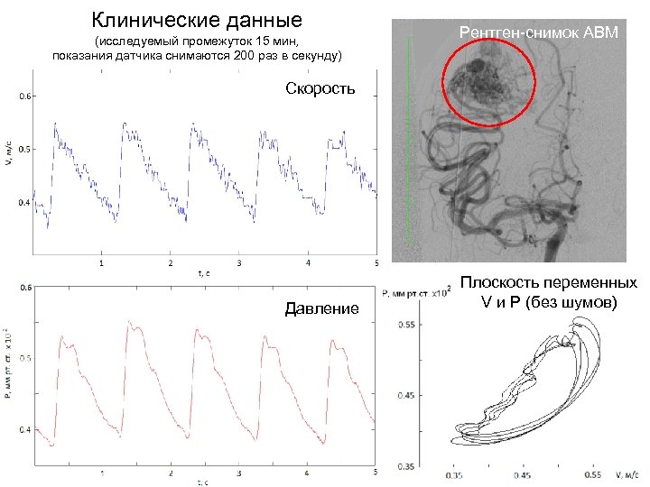 Клинические данные (исследуемый промежуток 15 мин, показания датчика снимаются 200 раз в секунду) Рентген-снимок