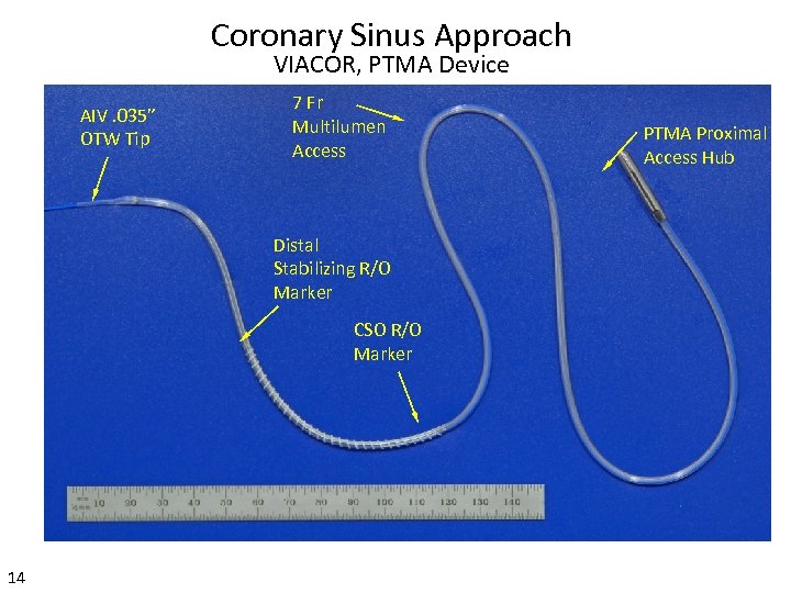 Coronary Sinus Approach VIACOR, PTMA Device AIV. 035” OTW Tip 7 Fr Multilumen Access