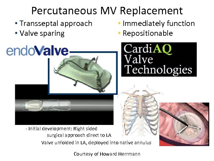 Percutaneous MV Replacement • Transseptal approach • Valve sparing (like repair) • Immediately function