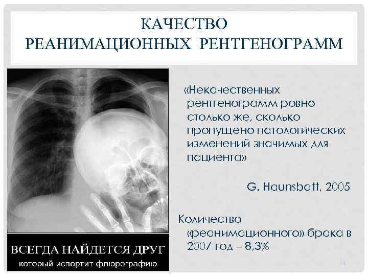 КАЧЕСТВО РЕАНИМАЦИОННЫХ РЕНТГЕНОГРАММ «Некачественных рентгенограмм ровно столько же, сколько пропущено патологических изменений значимых для