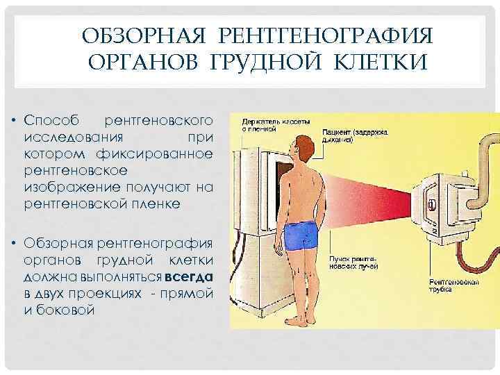 ОБЗОРНАЯ РЕНТГЕНОГРАФИЯ ОРГАНОВ ГРУДНОЙ КЛЕТКИ • Способ рентгеновского исследования при котором фиксированное рентгеновское изображение