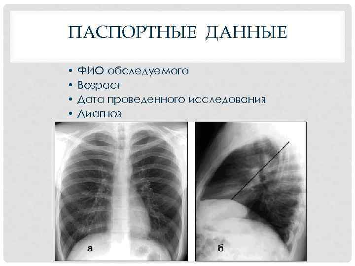 ПАСПОРТНЫЕ ДАННЫЕ • • ФИО обследуемого Возраст Дата проведенного исследования Диагноз 