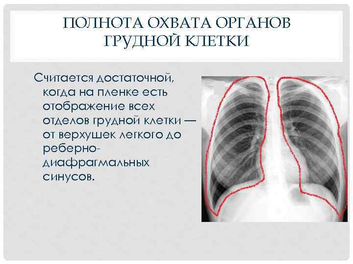 ПОЛНОТА ОХВАТА ОРГАНОВ ГРУДНОЙ КЛЕТКИ Считается достаточной, когда на пленке есть отображение всех отделов