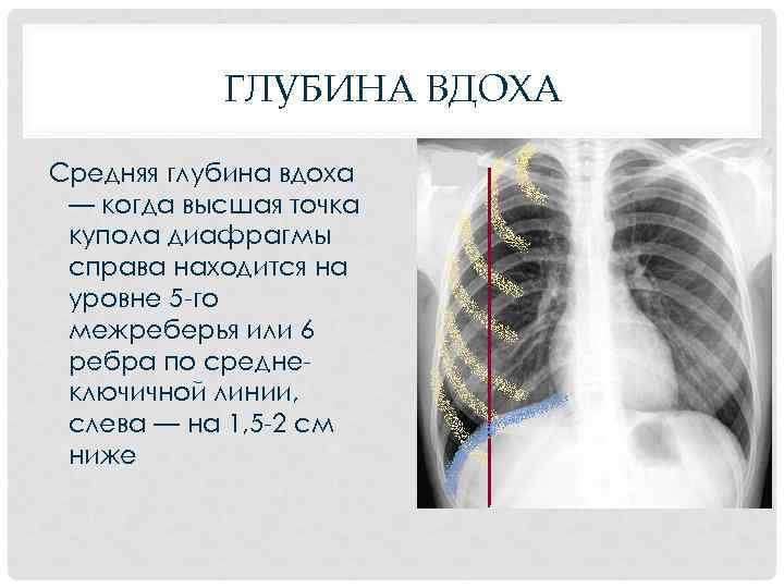 ГЛУБИНА ВДОХА Средняя глубина вдоха — когда высшая точка купола диафрагмы справа находится на