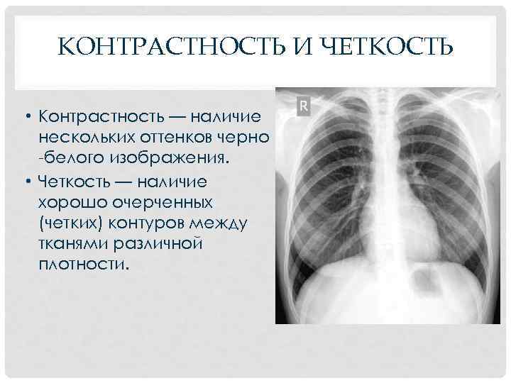 КОНТРАСТНОСТЬ И ЧЕТКОСТЬ • Контрастность — наличие нескольких оттенков черно -белого изображения. • Четкость