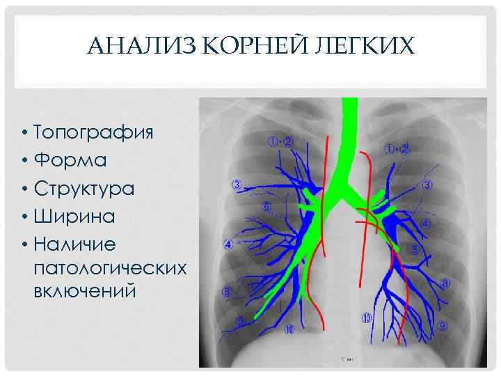 АНАЛИЗ КОРНЕЙ ЛЕГКИХ • Топография • Форма • Структура • Ширина • Наличие патологических