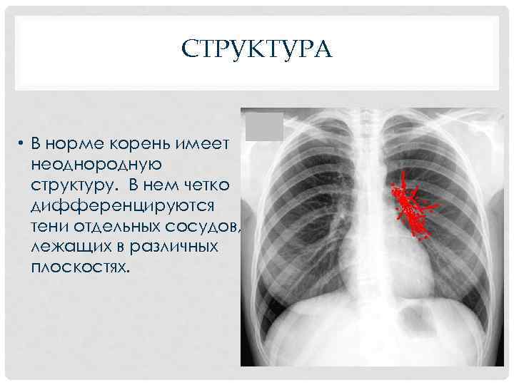 СТРУКТУРА • В норме корень имеет неоднородную структуру. В нем четко дифференцируются тени отдельных