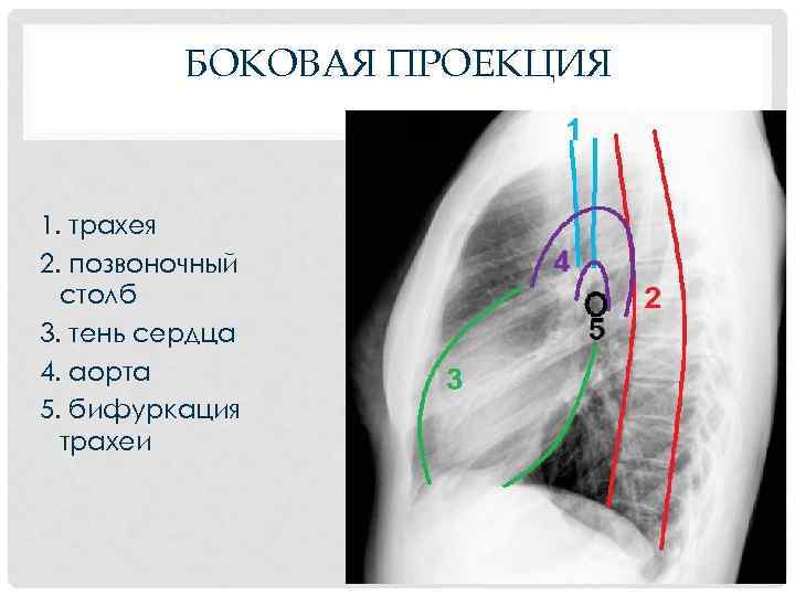 БОКОВАЯ ПРОЕКЦИЯ 1. трахея 2. позвоночный столб 3. тень сердца 4. аорта 5. бифуркация