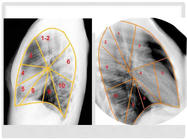 Схема сегментов легких на рентгене