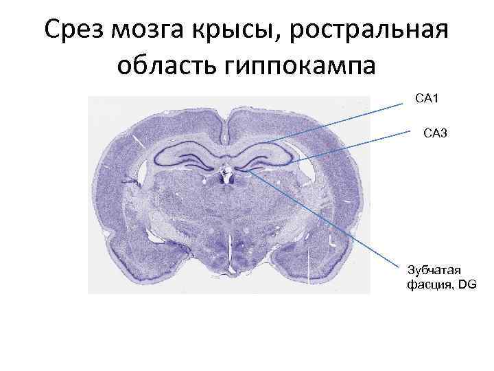 Срез мозга. Срез гиппокампа гистология. Зубчатая фасция гиппокампа. Гиппокамп на срезе.