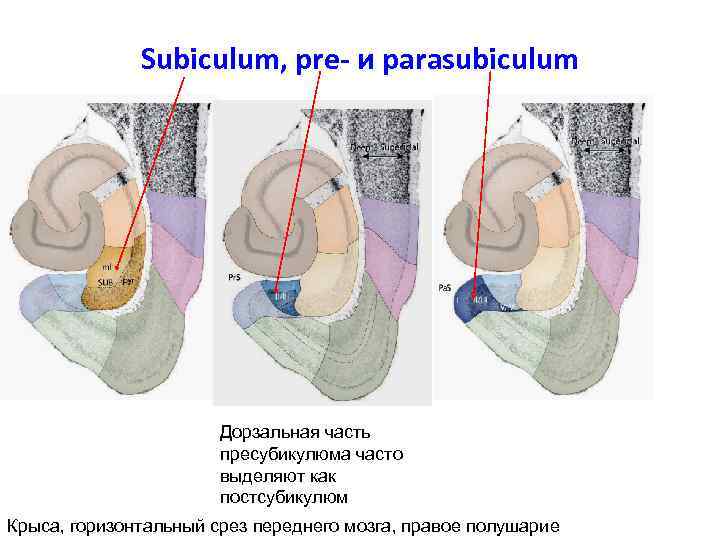 Subiculum, pre- и parasubiculum Дорзальная часть пресубикулюма часто выделяют как постсубикулюм Крыса, горизонтальный срез