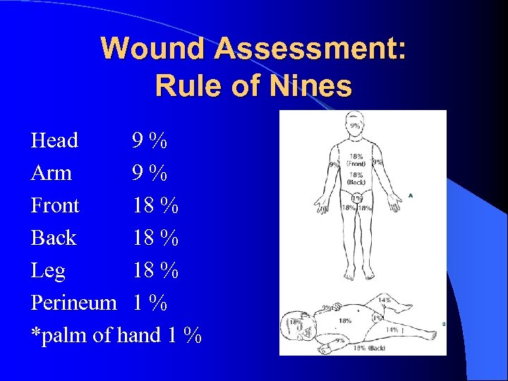 Wound Assessment: Rule of Nines Head 9% Arm 9% Front 18 % Back 18