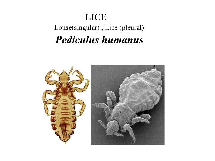 LICE Louse(singular) , Lice (pleural) Pediculus humanus 