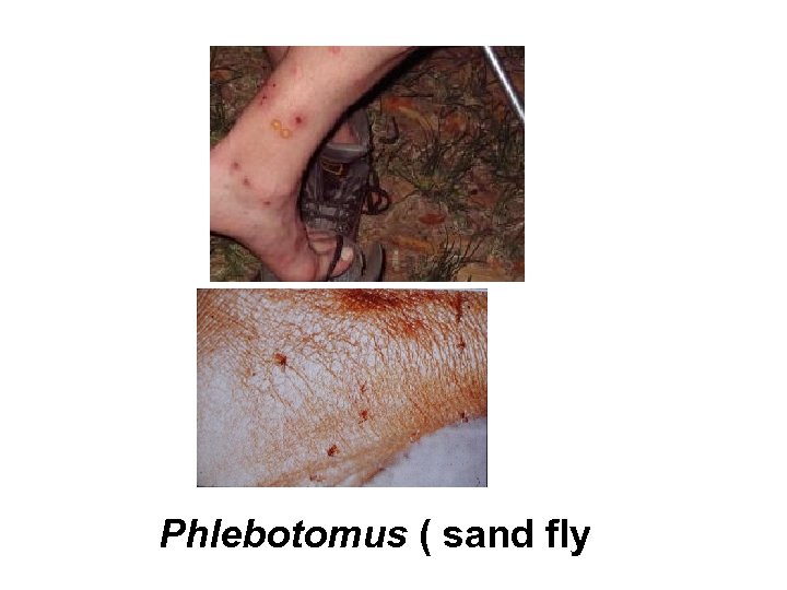 Phlebotomus ( sand fly 