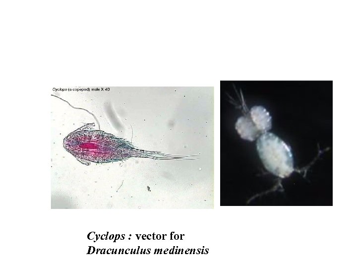 Cyclops : vector for Dracunculus medinensis 