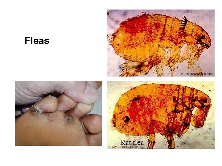 Fleas Rat flea 