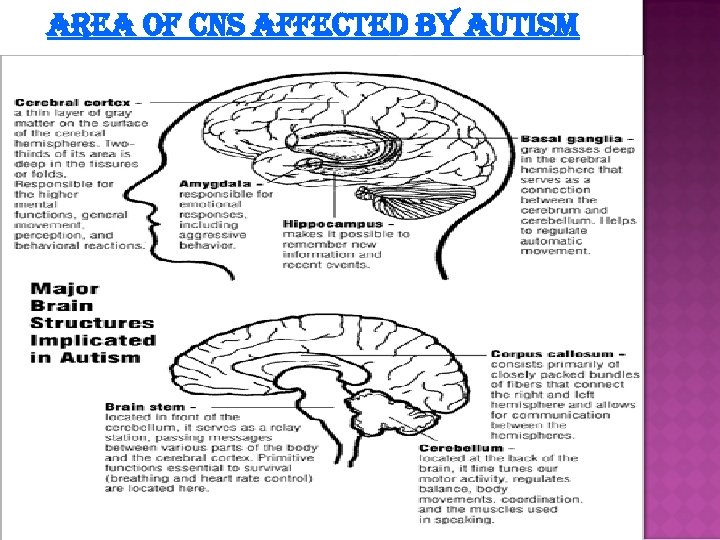 AREA OF CNS AFFECTED BY AUTISM 