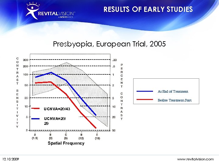 RESULTS OF EARLY STUDIES Presbyopia, European Trial, 2005 12 Months Post Treatment At End