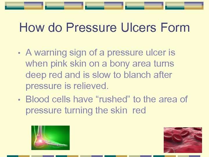 How do Pressure Ulcers Form A warning sign of a pressure ulcer is when