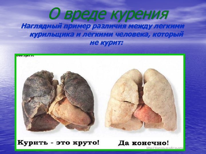 О вреде курения Наглядный пример различия между легкими курильщика и легкими человека, который не