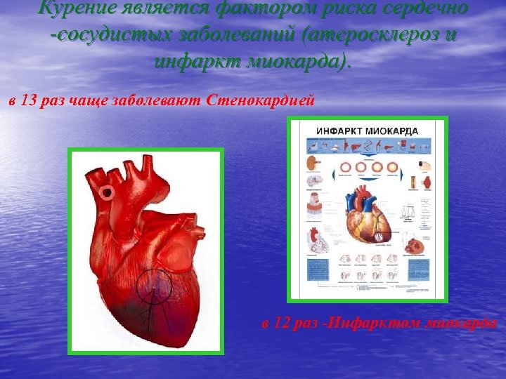 Курение является фактором риска сердечно -сосудистых заболеваний (атеросклероз и инфаркт миокарда). в 13 раз