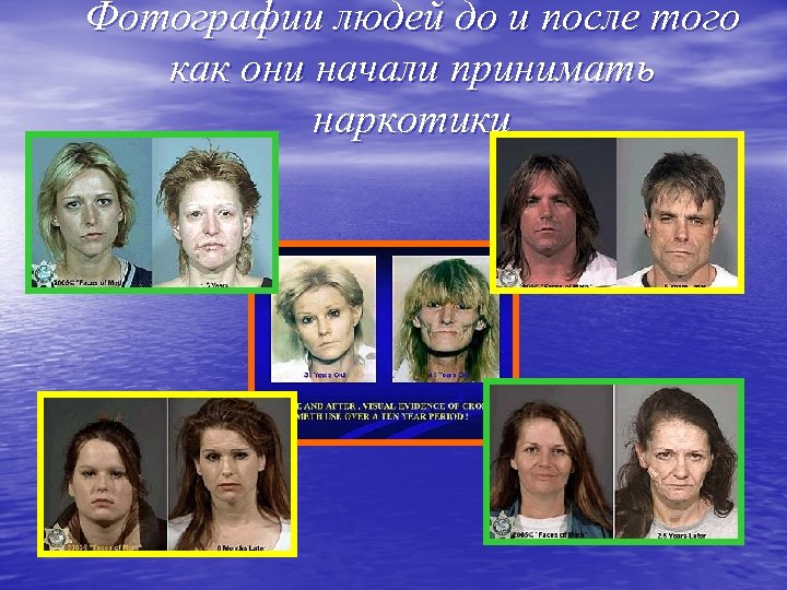 Фотографии людей до и после того как они начали принимать наркотики 