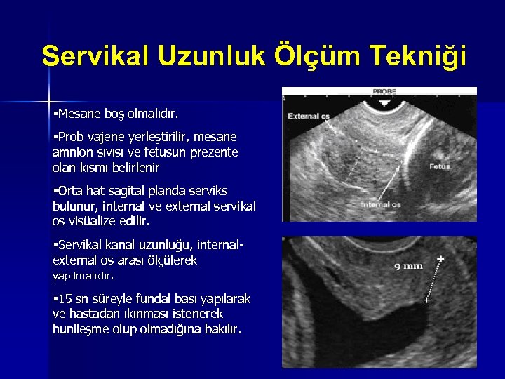 Servikal Uzunluk Ölçüm Tekniği §Mesane boş olmalıdır. §Prob vajene yerleştirilir, mesane amnion sıvısı ve