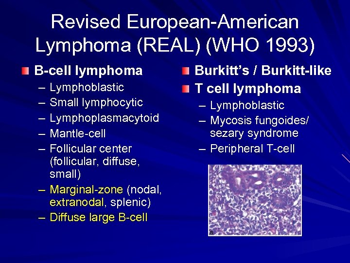 Revised European-American Lymphoma (REAL) (WHO 1993) B-cell lymphoma – – – Lymphoblastic Small lymphocytic