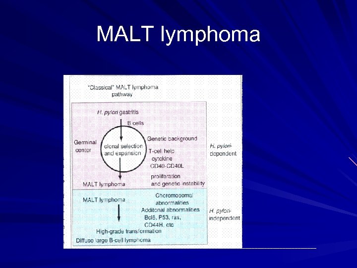 MALT lymphoma 