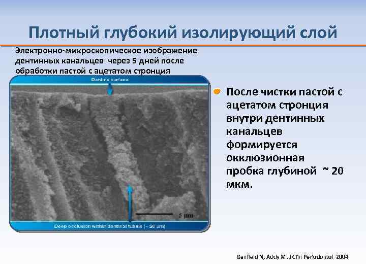 Плотный глубокий изолирующий слой Электронно-микроскопическое изображение дентинных канальцев через 5 дней после обработки пастой