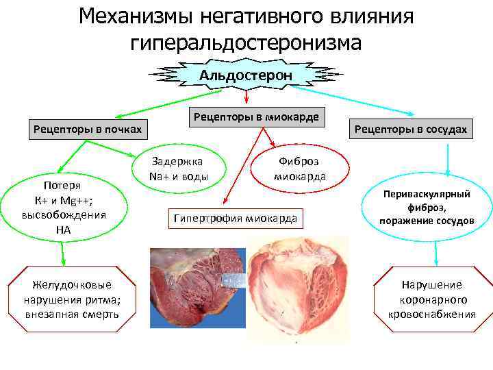 Первичный гиперальдостеронизм презентация