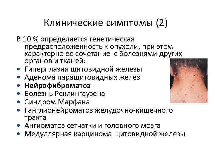 Клинические симптомы (2) В 10 % определяется генетическая предрасположенность к опухоли, при этом характерно