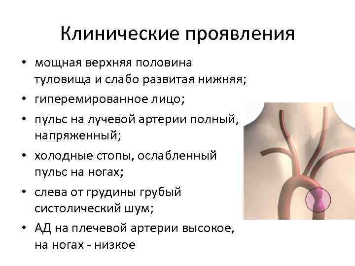 Клинические проявления • мощная верхняя половина туловища и слабо развитая нижняя; • гиперемированное лицо;