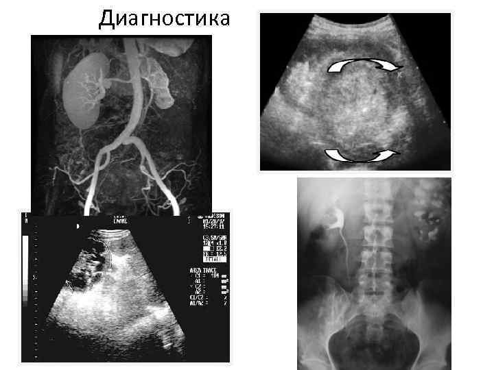 Диагностика 