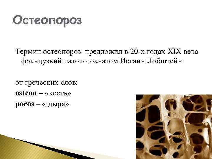 Остеопороз Термин остеопороз предложил в 20 -х годах XIX века французкий патологоанатом Иоганн Лобштейн