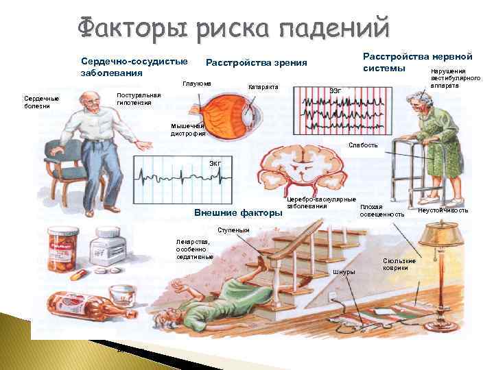 Факторы риска падений Сердечно-сосудистые заболевания Глаукома Сердечные болезни Расстройства нервной системы Нарушения Расстройства зрения