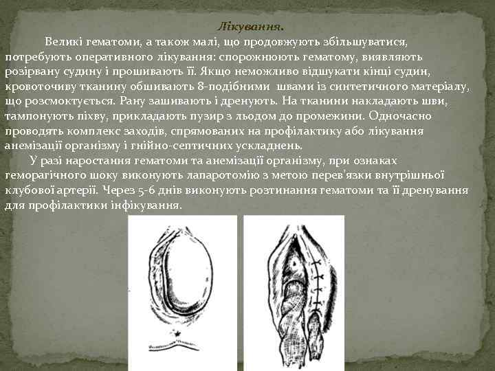 Лікування. Великі гематоми, а також малі, що продовжують збільшуватися, потребують оперативного лікування: спорожнюють гематому,