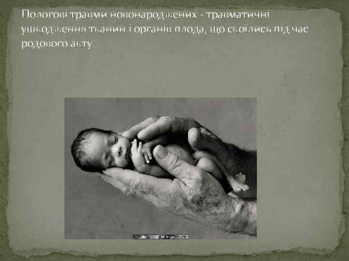 Пологові травми новонароджених - травматичні ушкодження тканин і органів плода, що скоїлись під час